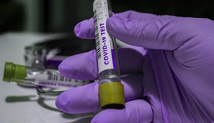 В Курской области выявили 133 новых случая коронавируса