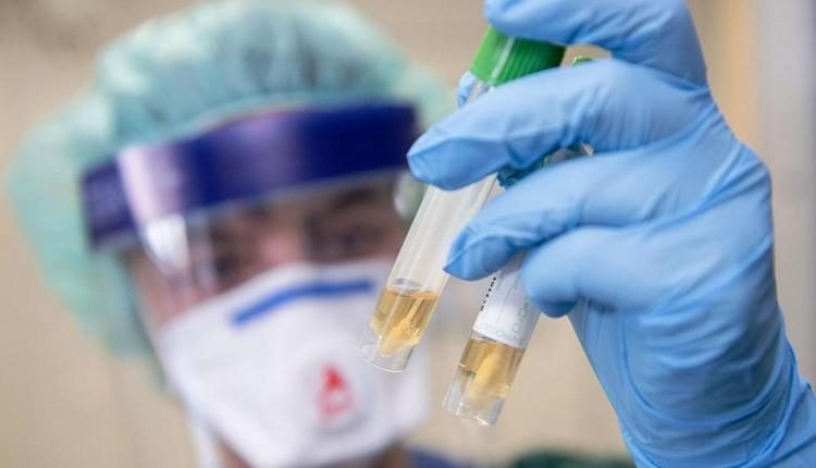 Курский врач рассказал о парадоксальных случаях коронавируса