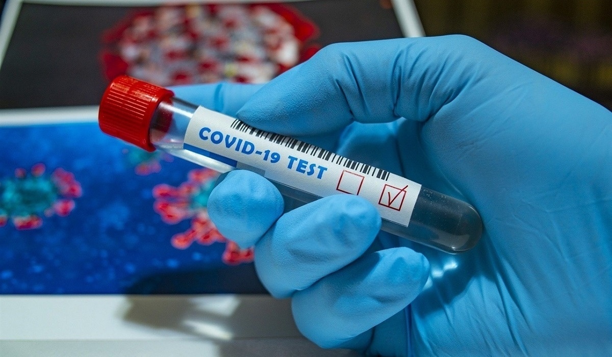 У 670 человек из Курской области за сутки выявили коронавирус