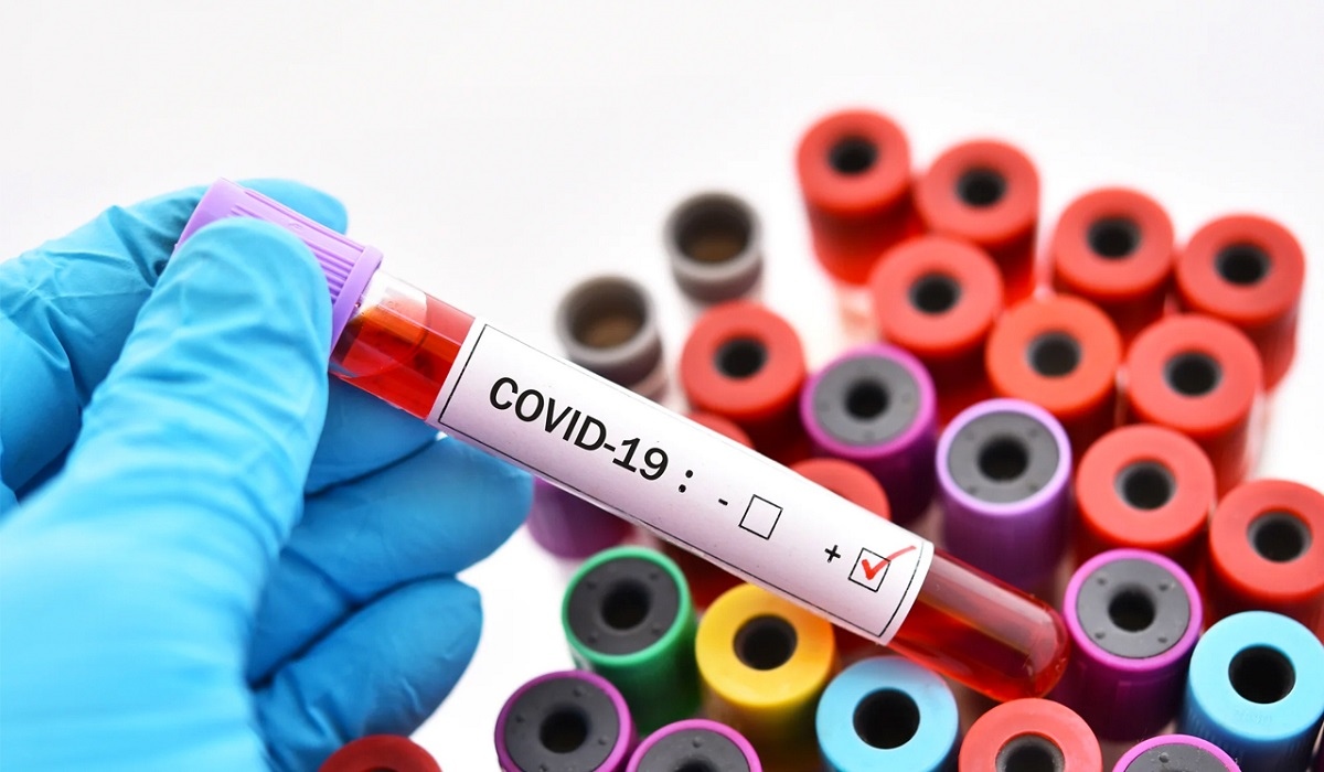 176 курян заболели коронавирусом за сутки