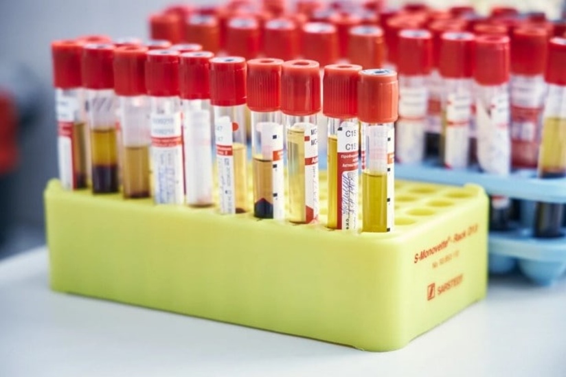В Курске проводят тесты на определение вируса папилломы человека