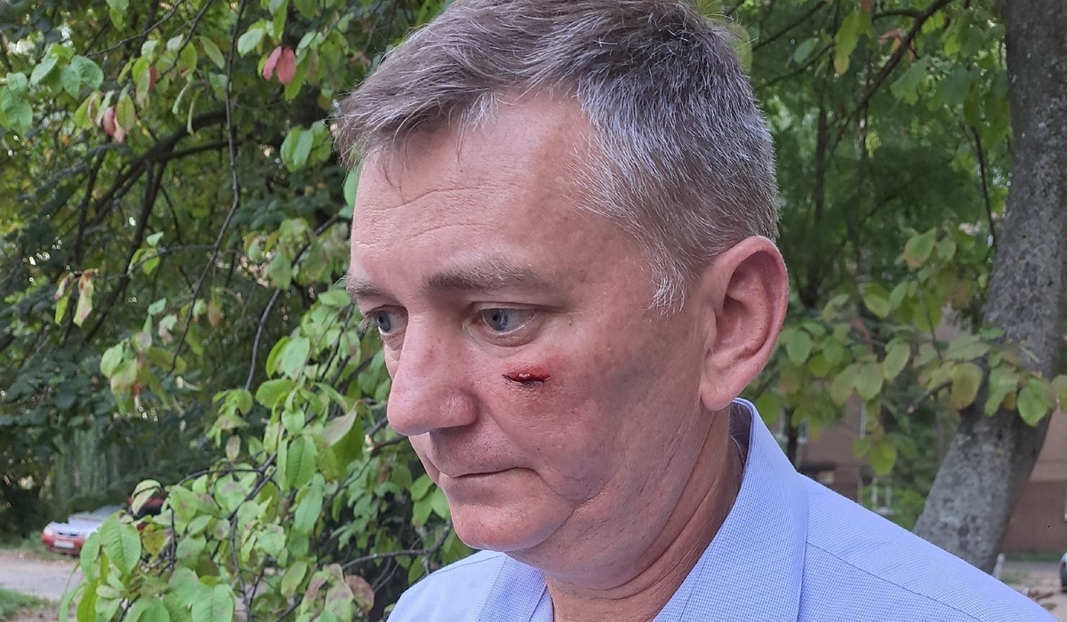 В Курске неизвестный в маске напал на директора управляющей компании